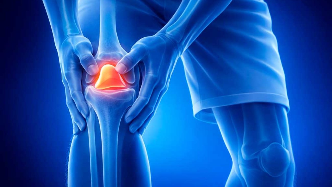 o-que-e-condropatia-patelar-e-como-tratar
