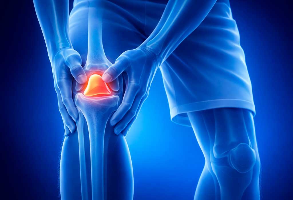 o-que-e-condropatia-patelar-e-como-tratar